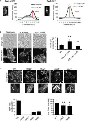 Baseplate Component TssK and Spatio-Temporal Assembly of T6SS in Pseudomonas aeruginosa